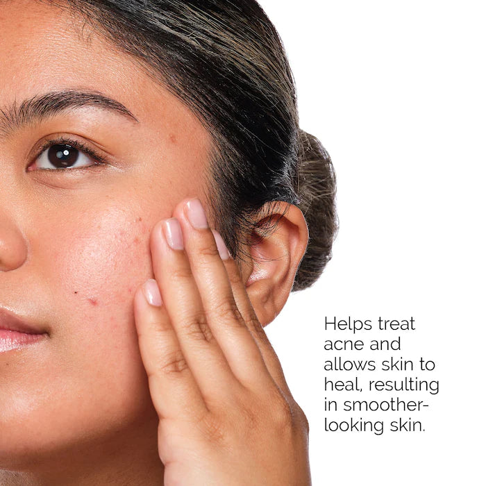 The Ordinary - The Acne Set with Salicylic Acid