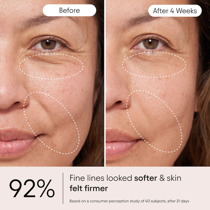 ALPYN - Super Peptide & Ghostberry Moisturizer for Eczema, Barrier and Wrinkle Repair