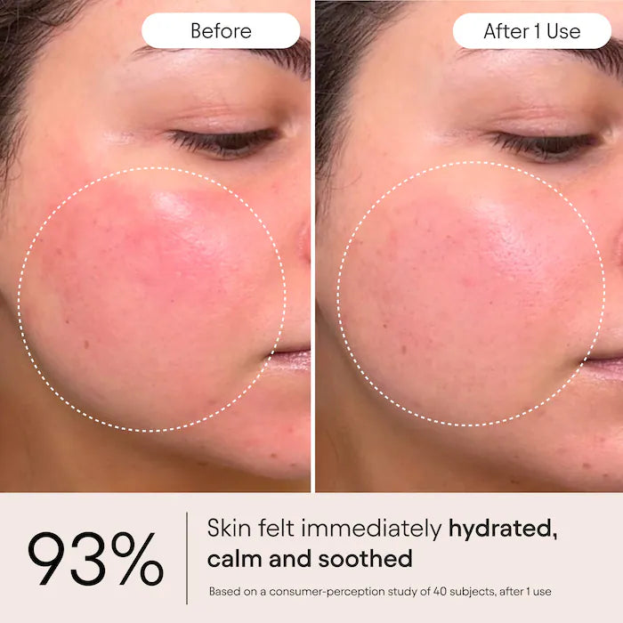 ALPYN - Super Peptide & Ghostberry Moisturizer for Eczema, Barrier and Wrinkle Repair