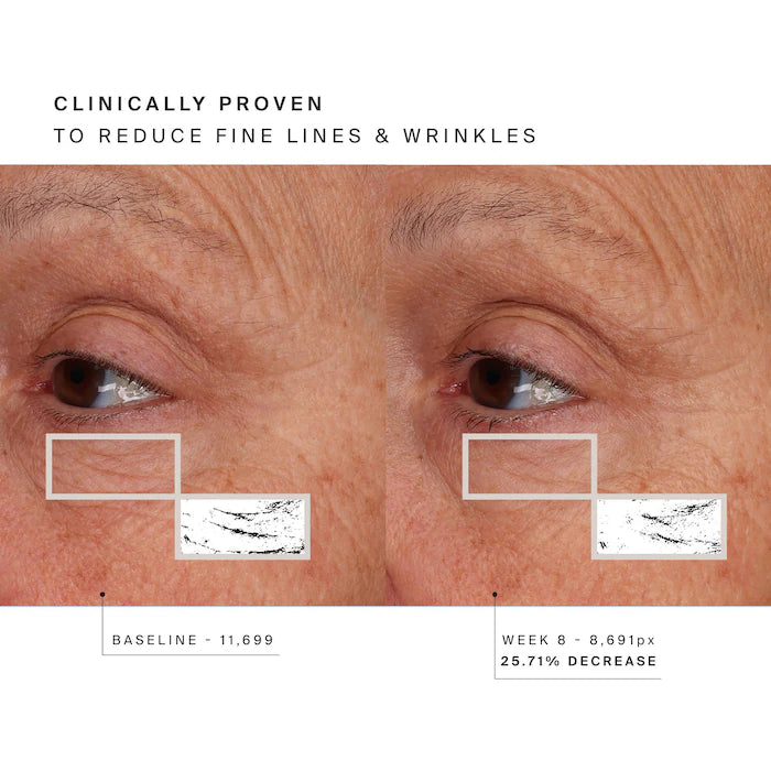 HigherDOSE - Red Light Face Mask for Fine Lines & Glowing Skin