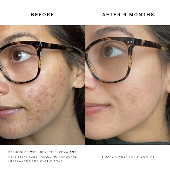 HigherDOSE - Red Light Face Mask for Fine Lines & Glowing Skin