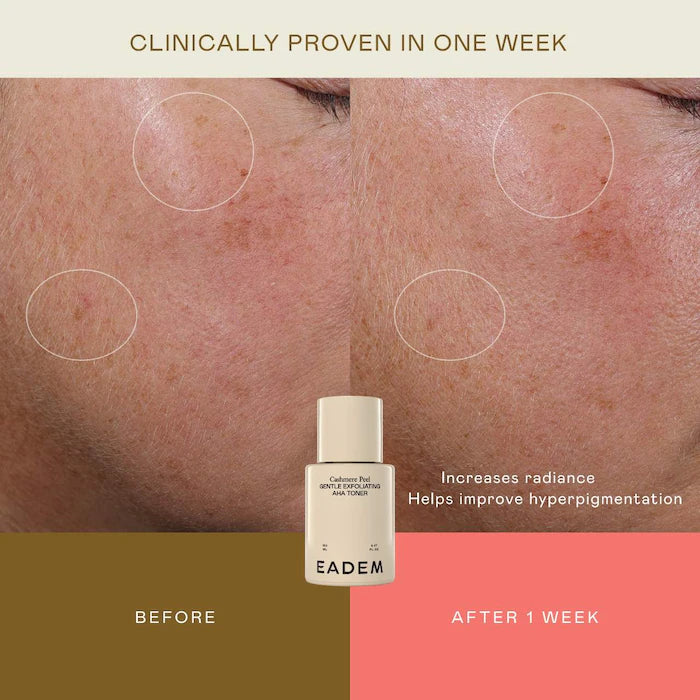 EADEM - Cashmere Peel Milky Exfoliant & Hydrating Essence — Daily AHA + PHA Formula with 9% Azelaic, Lactic & Tranexamic Acids