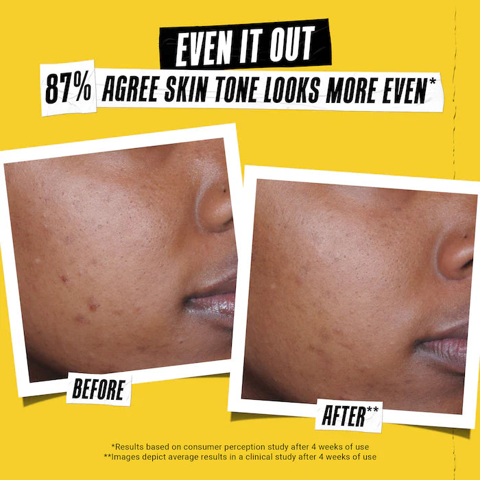 Kiehl's Since 1851 - Better Screen™ UV Serum SPF 50+ Facial Sunscreen with Collagen Peptide