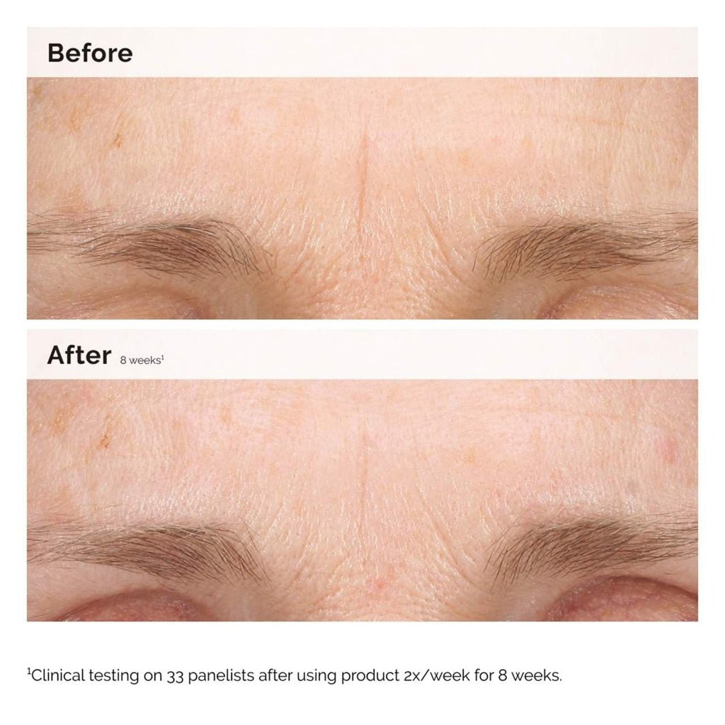 The Ordinary - Retinal 0.2% Emulsion High-Strength Retinoid Nighttime Treatment