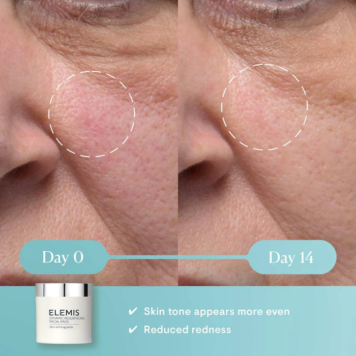 Elemis - Mini Dynamic Gentle Resurfacing Pads with Lactic Acid
