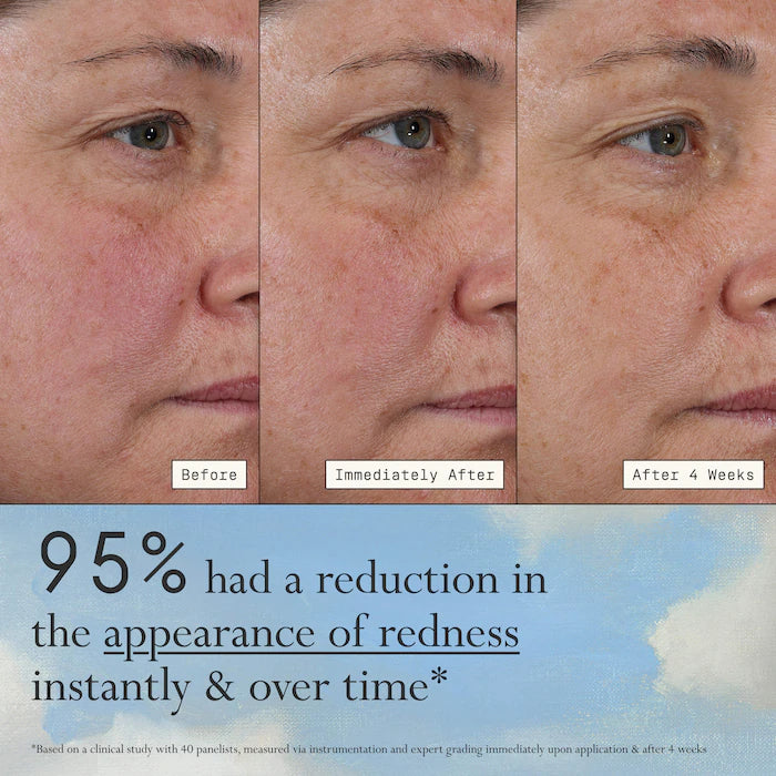 Dieux - Deliverance 3-in-1 Repair Serum for Redness, Wrinkles, Dark Spots