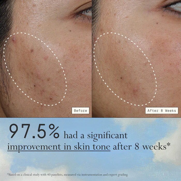 Dieux - Deliverance 3-in-1 Repair Serum for Redness, Wrinkles, Dark Spots