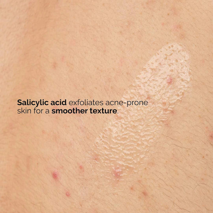  The Ordinary - Salicylic Acid 0.5% Body Serum Exfoliating Treatment for Acne