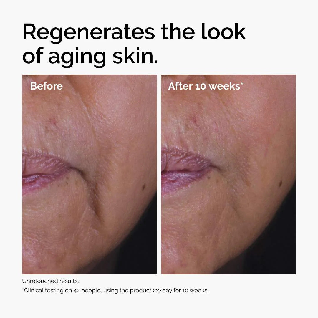  The Ordinary - GF 15% Serum for Visible Skin Repair and Wrinkles

