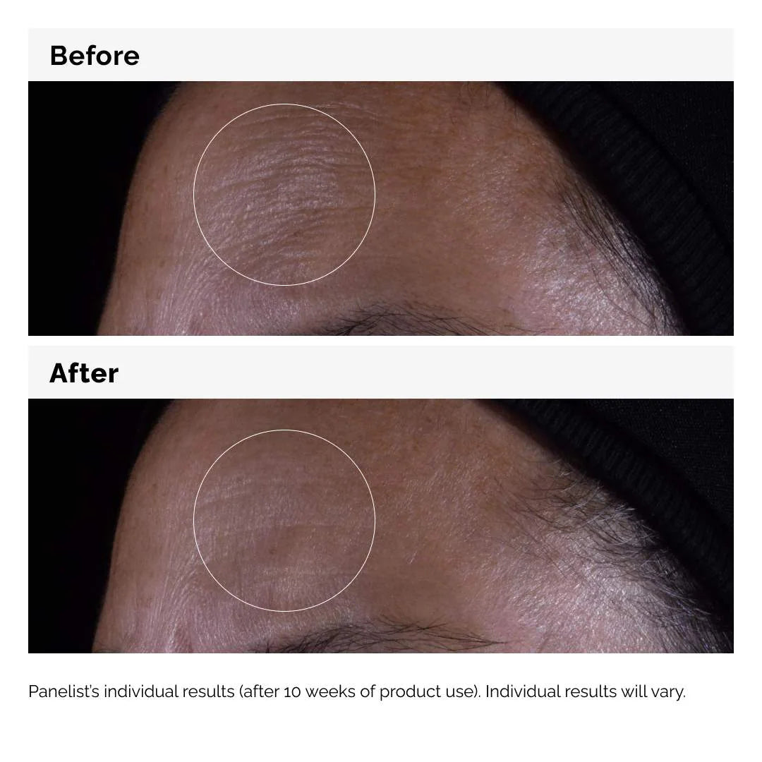  The Ordinary - GF 15% Serum for Visible Skin Repair and Wrinkles