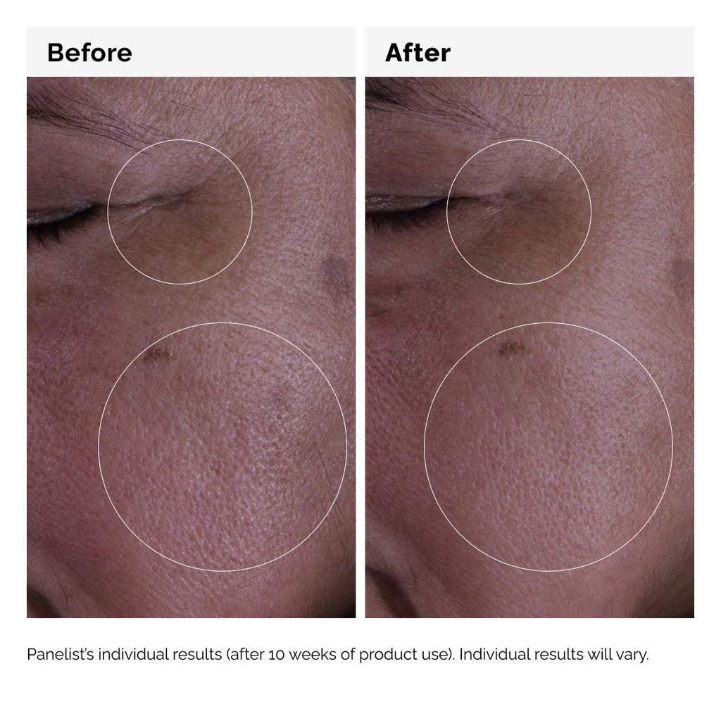  The Ordinary - GF 15% Serum for Visible Skin Repair and Wrinkles