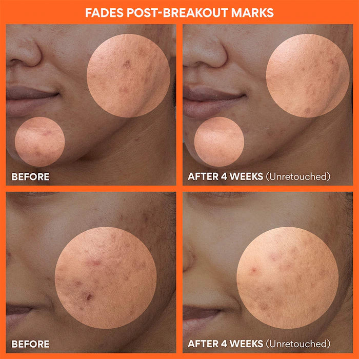 innisfree  Daily Vitamin C Korean Brightening Toner Pads with Niacinamide for Dark Spots