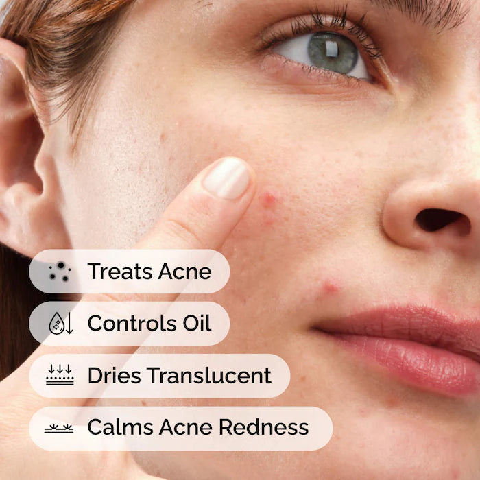 The Ordinary - Sulfur 10% Powder-to-Cream Concentrate Acne Spot Treatment