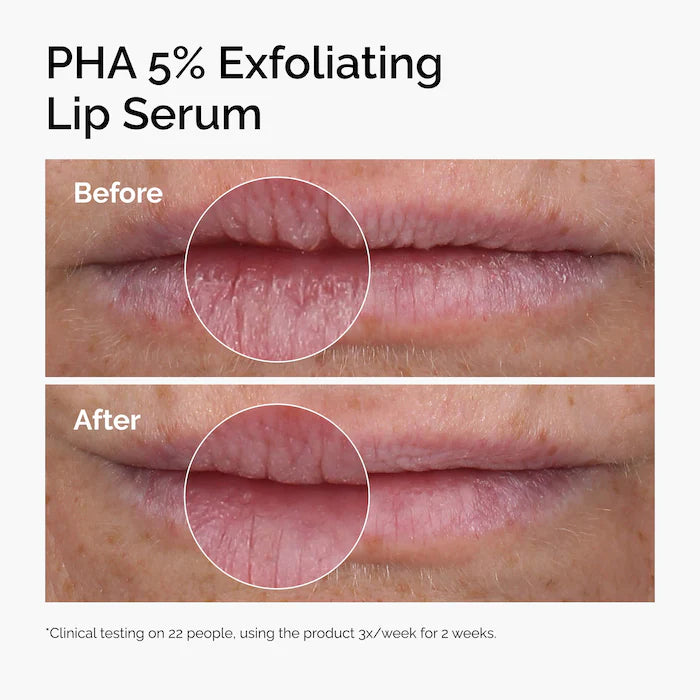 The Ordinary - PHA 5% Exfoliating Lip Serum