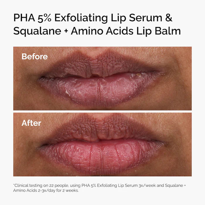 The Ordinary - PHA 5% Exfoliating Lip Serum
