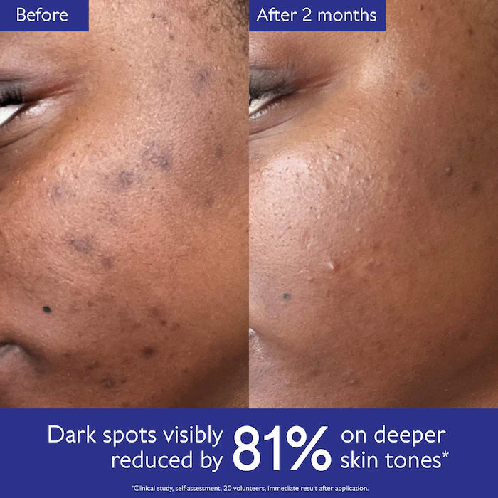 Caudalie - Vinoperfect Brightening Dark Spot Serum Vitamin C Alternative