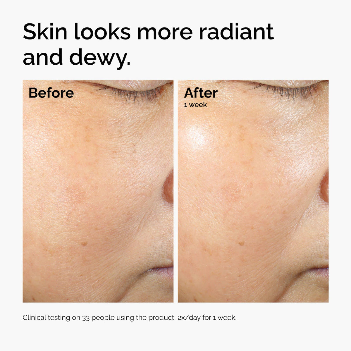 The Ordinary - Rice Lipids + Ectoin Microemulsion Moisturizer for Soothing Hydration & Reduced Redness