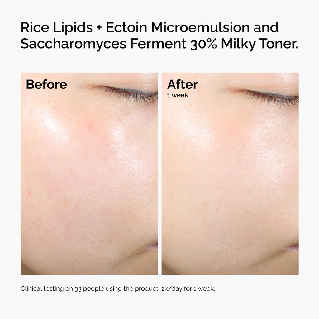 The Ordinary - Rice Lipids + Ectoin Microemulsion Moisturizer for Soothing Hydration & Reduced Redness