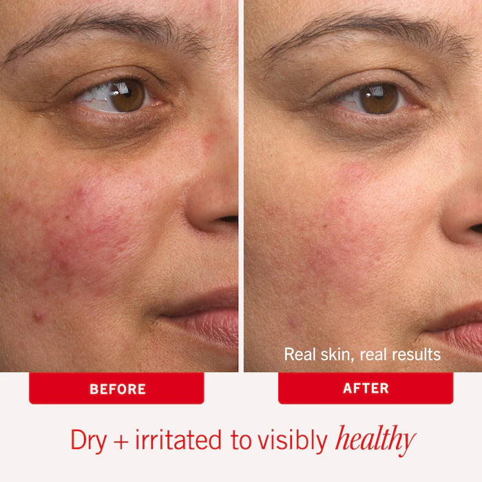 First Aid Beauty  Ultra Repair® Cream Intense Hydration – Face and Body Moisturizer for Skin Repair