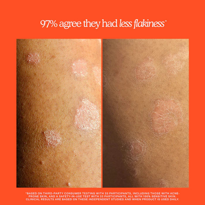 Tower 28 Beauty - SOS Rescue + Relief Body Wash Treatment