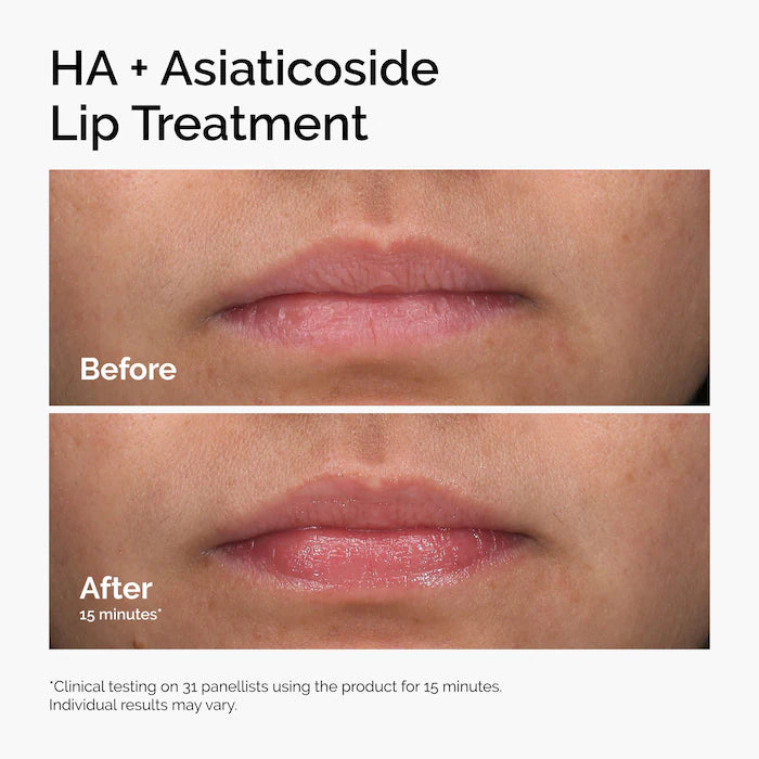  The Ordinary - HA + Asiaticoside Lip Treatment