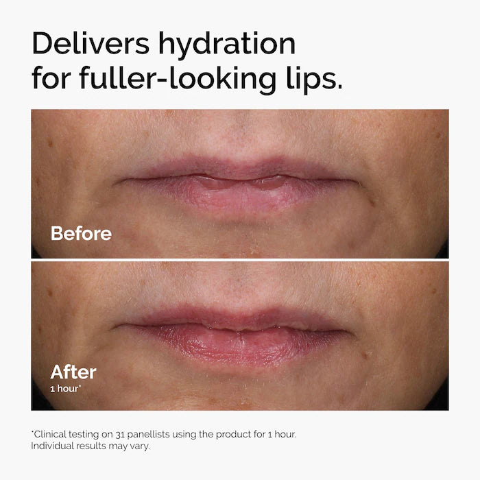  The Ordinary - HA + Asiaticoside Lip Treatment