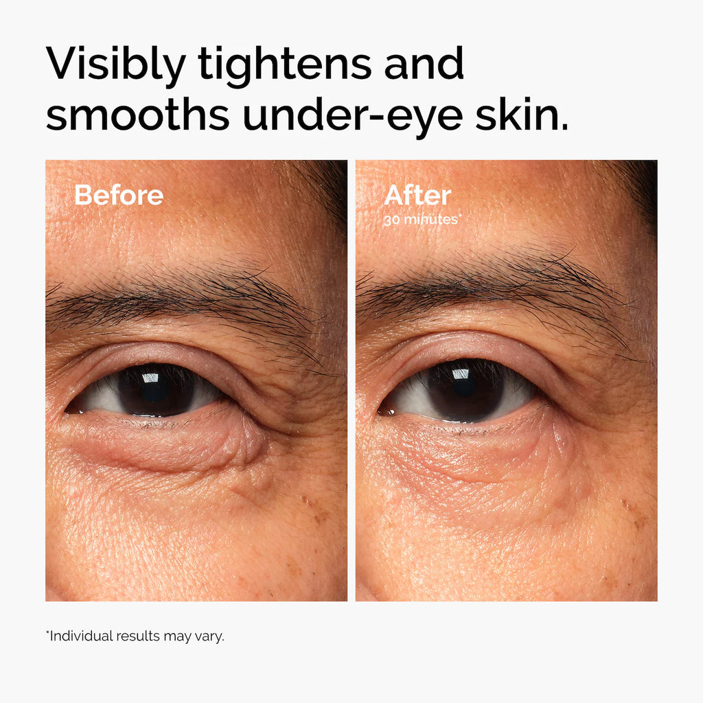 The Ordinary - Lacto-PDRN* 4% + B9 Eye Cream