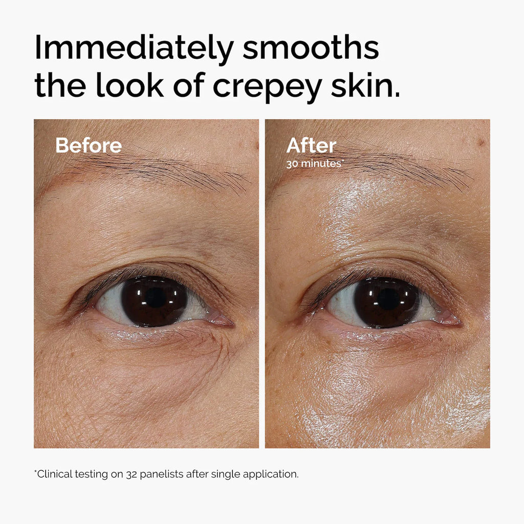 The Ordinary - Lacto-PDRN* 4% + B9 Eye Cream