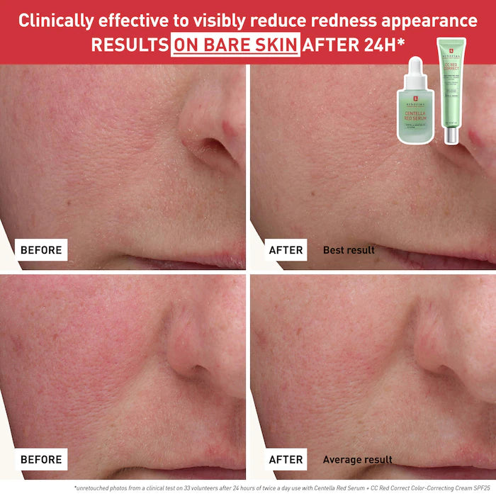 CC Red Correct Green Color-Corrector SPF 25 to Cover Redness, with Korean Centella Asiatica Extract